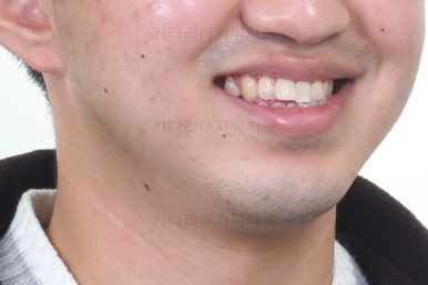 연산동교정전문치과