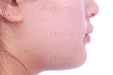 부산교정치과추천