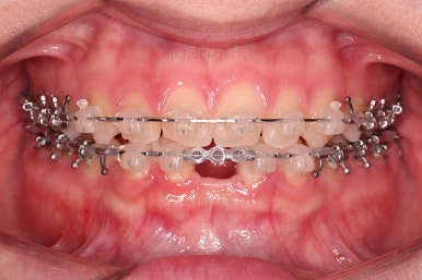 부산교정치과추천