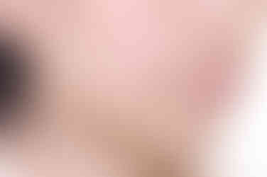 부산클리피씨교정