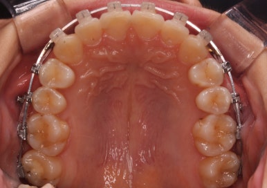 연산동교정치과