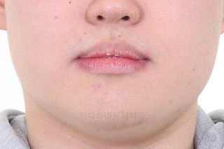 동래교정치과