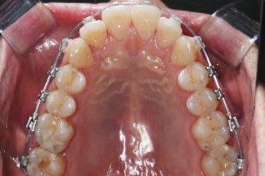 부산교정치과추천