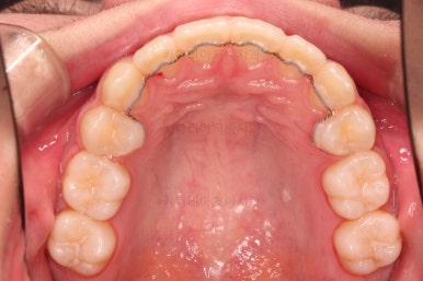 부산치아교정치과