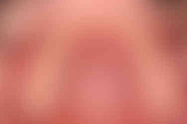 부산치아교정치과