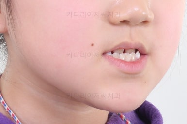 부산초등학생교정