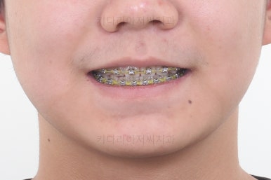 부산청소년교정