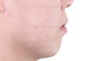 부산교정치과