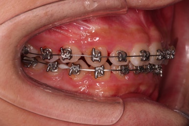 부산청소년교정