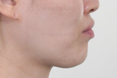 부산교정치과