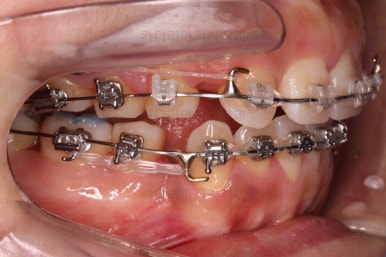 연산동교정치과