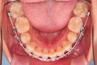 부산무턱교정치과