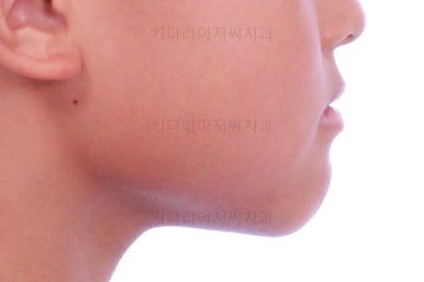 부산어린이교정