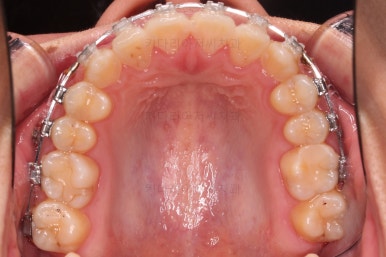 부산치아교정치과