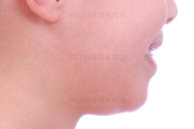 부산어린이교정