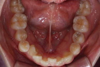 연산동교정치과