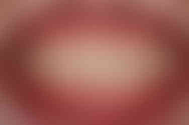 부산연산동부분교정