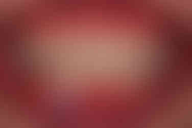 동래임플란트교정