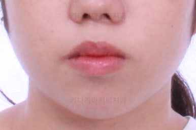 부산교정전문치과