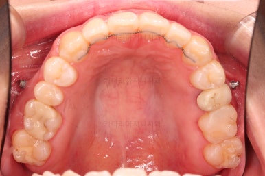 부산치아교정잘하는곳