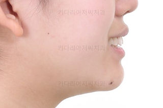 동래교정치과