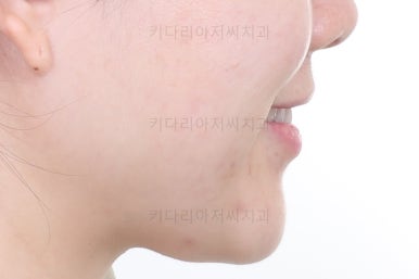 부산인비절라인