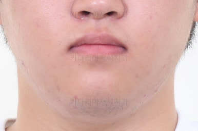 연산동교정