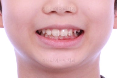 부산어린이교정