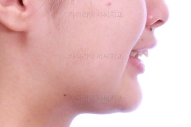 부산치아교정치과