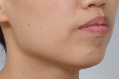 부산교정치과추천