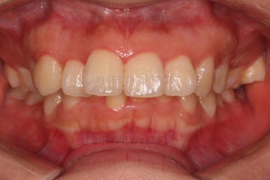 부산무턱교정치과