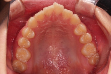 부산교정전문의