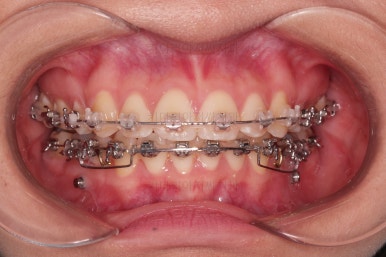 연산동치아교정치과