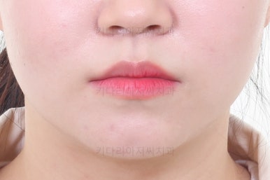 부산교정전문의