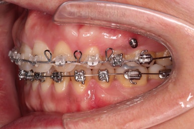 연산동교정치과