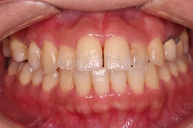 부산연산동치과