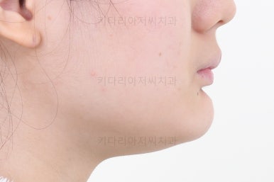 연산동치아교정