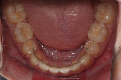 부산교정전문의