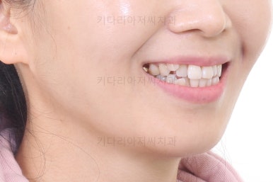 부산인비절라인