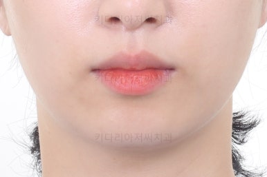 부산연산동부분교정