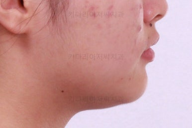 부산치아교정치과