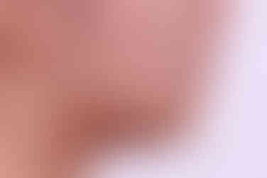 부산치아교정치과