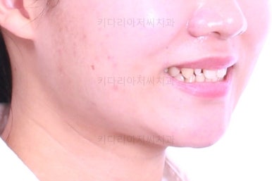 부산치아교정치과