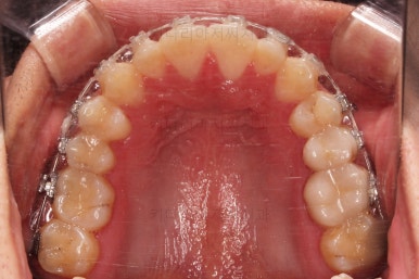 부산연제구교정