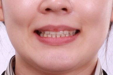 부산교정