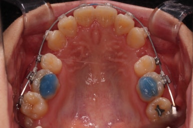 부산무턱교정치과