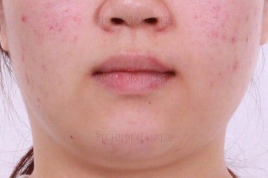부산치아교정치과