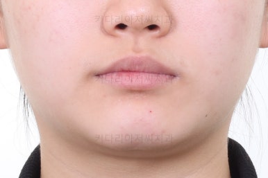 연산동교정치과