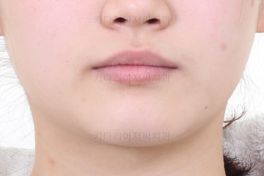 연산동교정치과