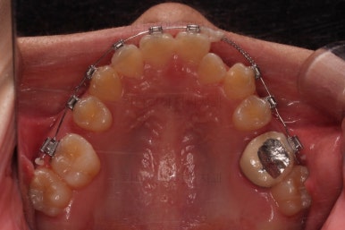 동래구치아교정